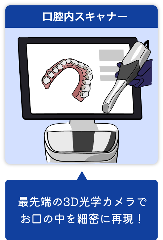 口腔内スキャナーは最先端の3D光学カメラでお口の中を細密に再現！